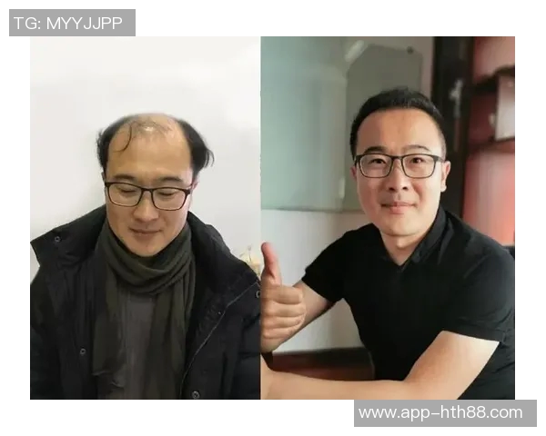 霍华德调侃布朗发际线问题推荐Tony助力解决秃顶烦恼 霍华德调侃布朗发际线问题推荐Tony助力解决秃顶烦恼